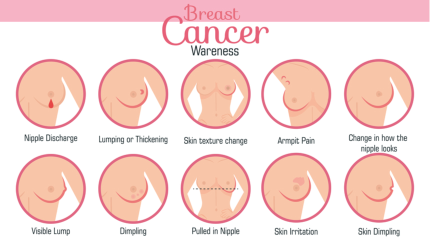 symptoms of breast cancer 