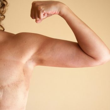 Everything You Need to Know About Mastectomy